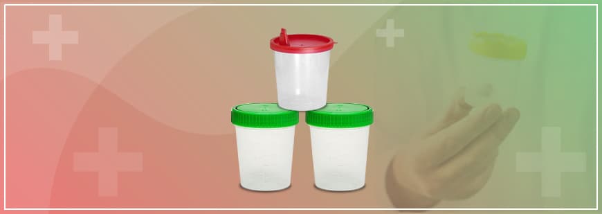 Urinbecher mit Schraub- oder Schnappverschluss